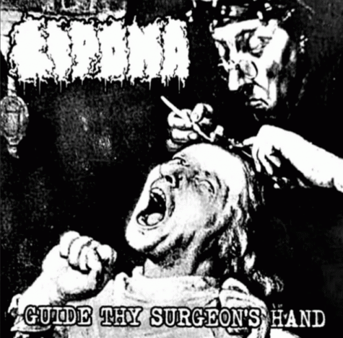 Lipoma : Guide Thy Surgeon's Hand